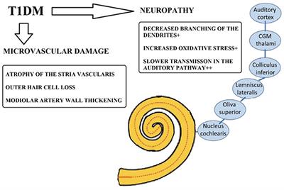 Hearing loss in type 1 diabetes mellitus: a need to understand precise pathological mechanisms and develop novel therapeutic approaches